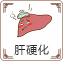 肝硬化